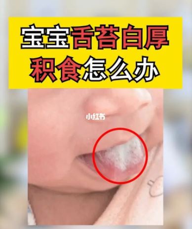 舌苔白又厚是怎么回事怎么辦